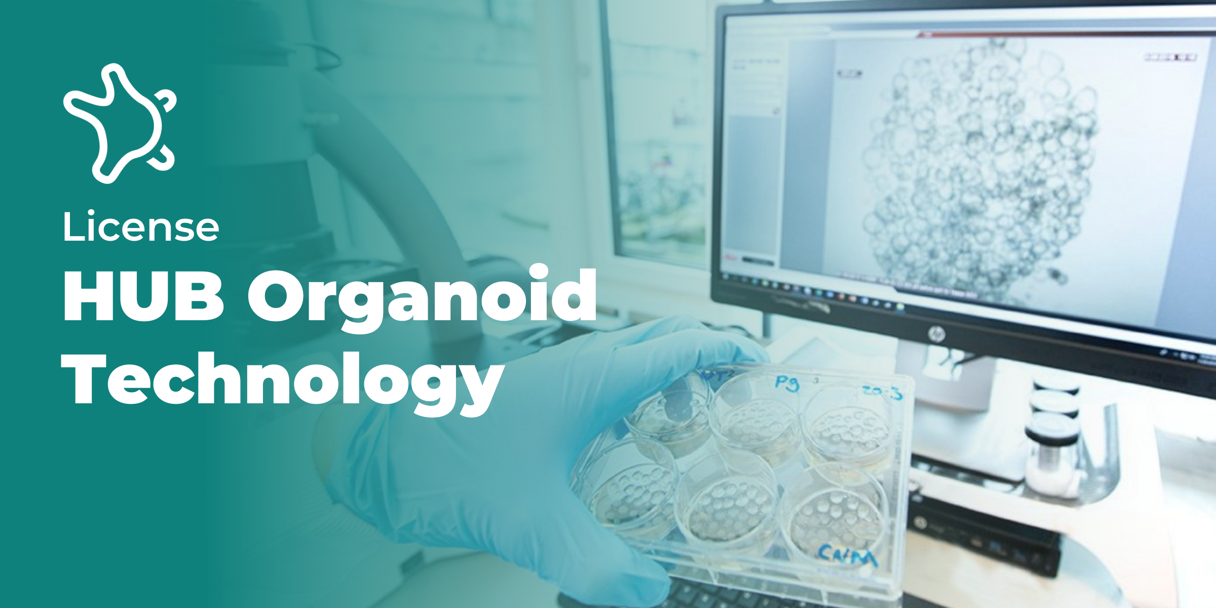 Do you need a license to work with HUB Organoid® Technology?